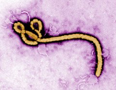 ebola virus